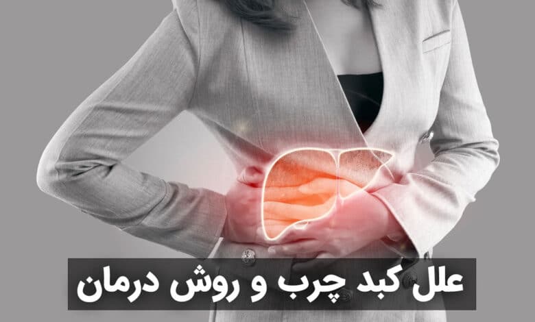 علائم کبد چرب و راه های درمان آن : راهنمای کامل و جامع